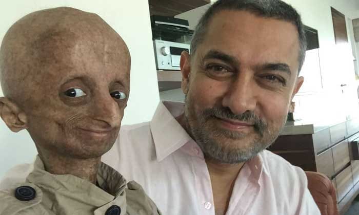 Progeria affected child nihal Bitla dies in telangana at the age of 15