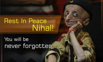 Progeria affected child nihal Bitla dies in telangana at the age of 15
