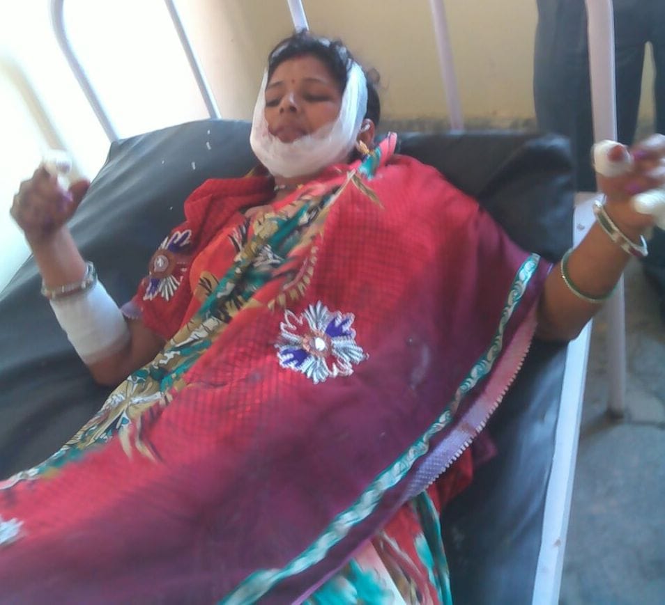 wife attacked by husband