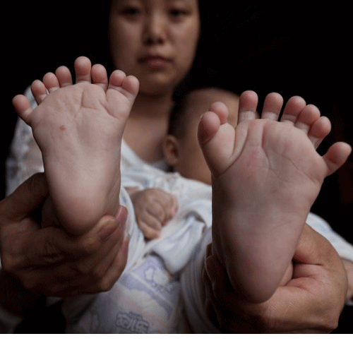 this baby boy has 16 toes