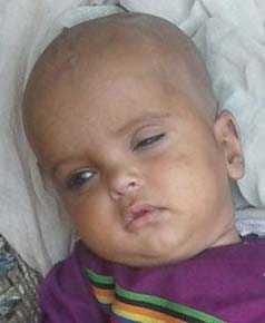  Mudsan knock of infectious diseases , child deaths