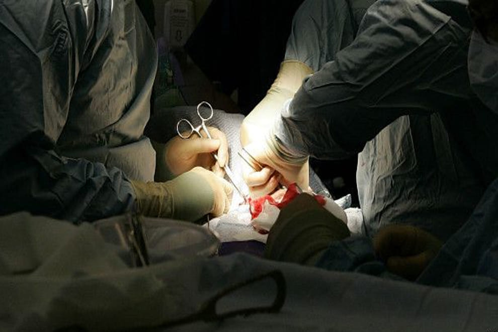 hiv infected organ transplant