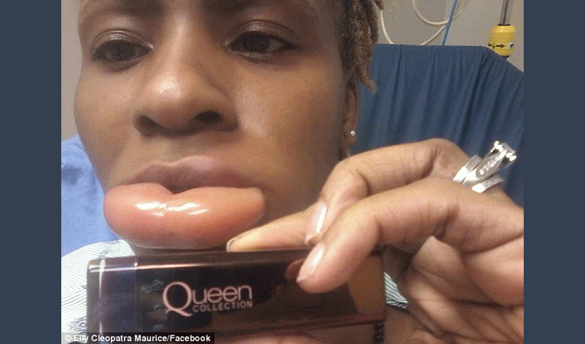 lipstick causes swollen of lips