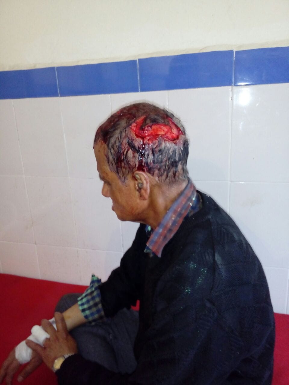 bear attack in ITBP colony,. five injured.