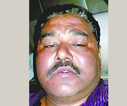  Police torture in Lalganj.