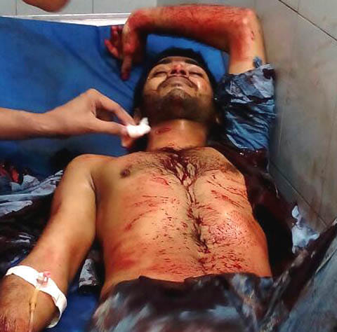  bullets fired at criminal