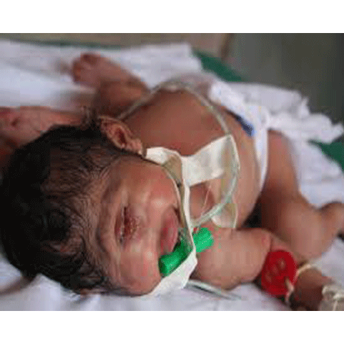 7 Unbelievable Genetic Accidents