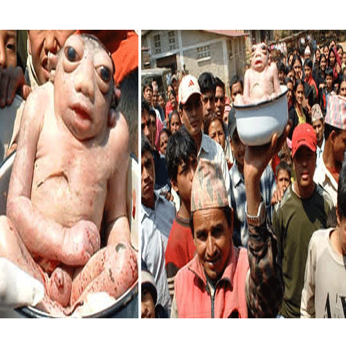 7 Unbelievable Genetic Accidents