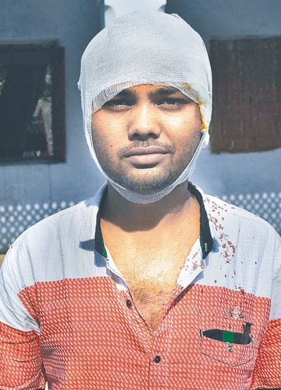 brothers brutely beaten by gokash