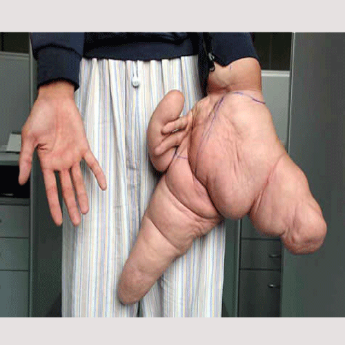 7 Unbelievable Genetic Accidents