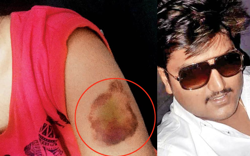 pune woman thrashed for wearing short dress
