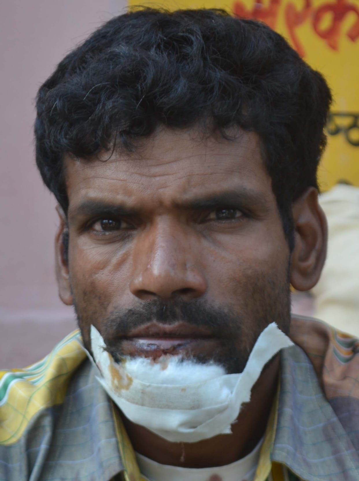 Full of the wedding car Upturned, six injured