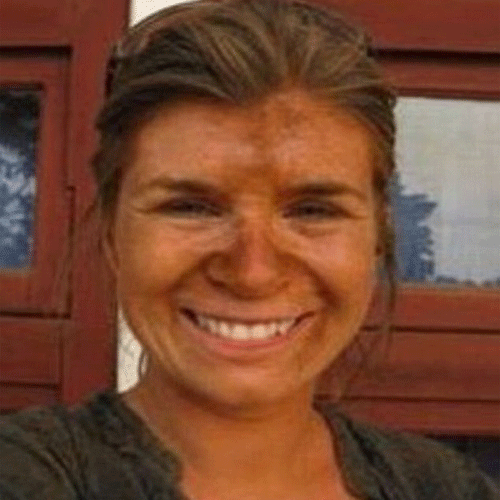 sunburn makes the face horrible