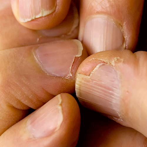 7 symptoms of calcium deficiency