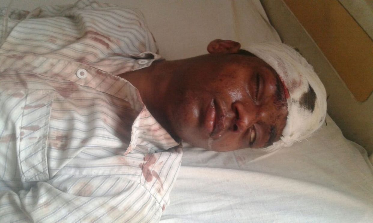 two man injured in the attack of jaireen, one trauma refer