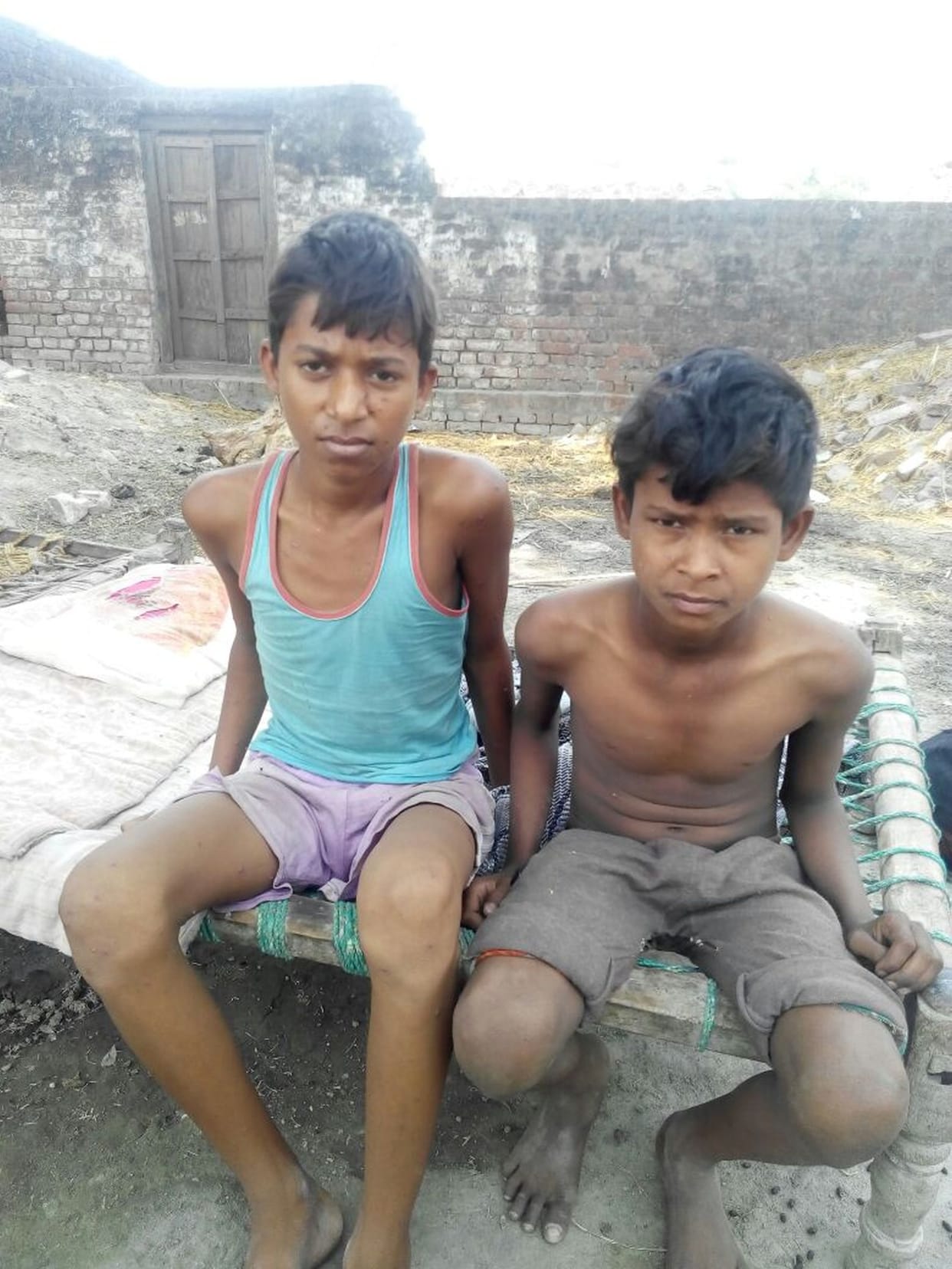 48 suffering from measles