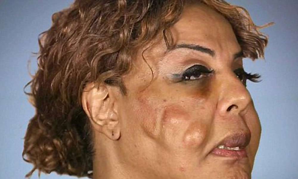 lady with cemented cheeks