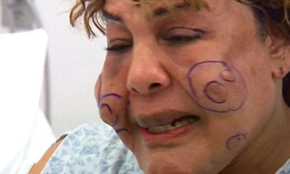 lady with cemented cheeks