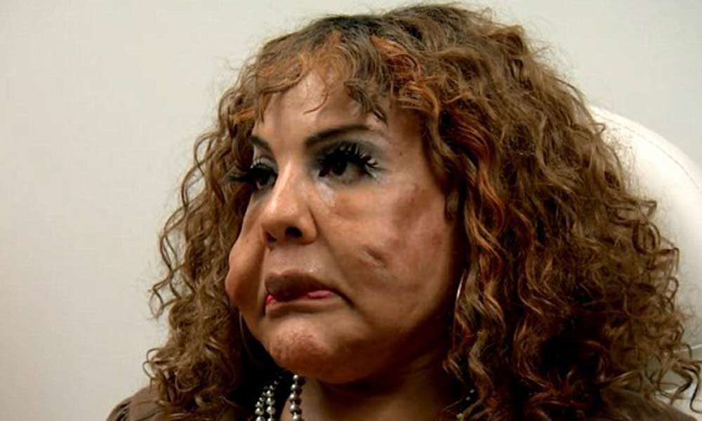 lady with cemented cheeks