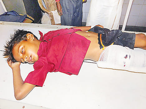 Harsh teens injured in firing