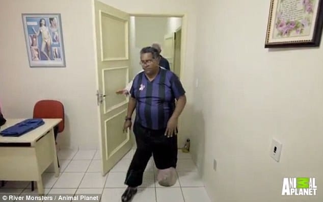 man infected by elephantiasis after bitten by mosquito