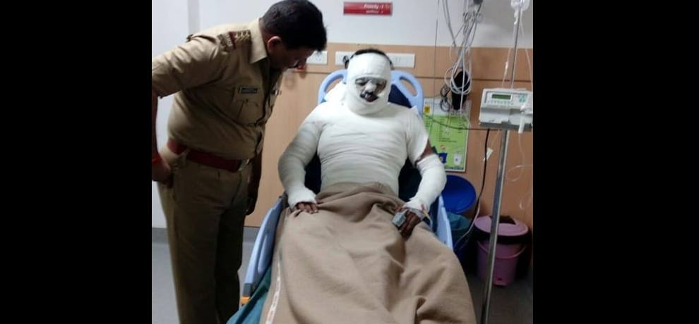 woman throws acid on lover doctor and escape in ghaziabad