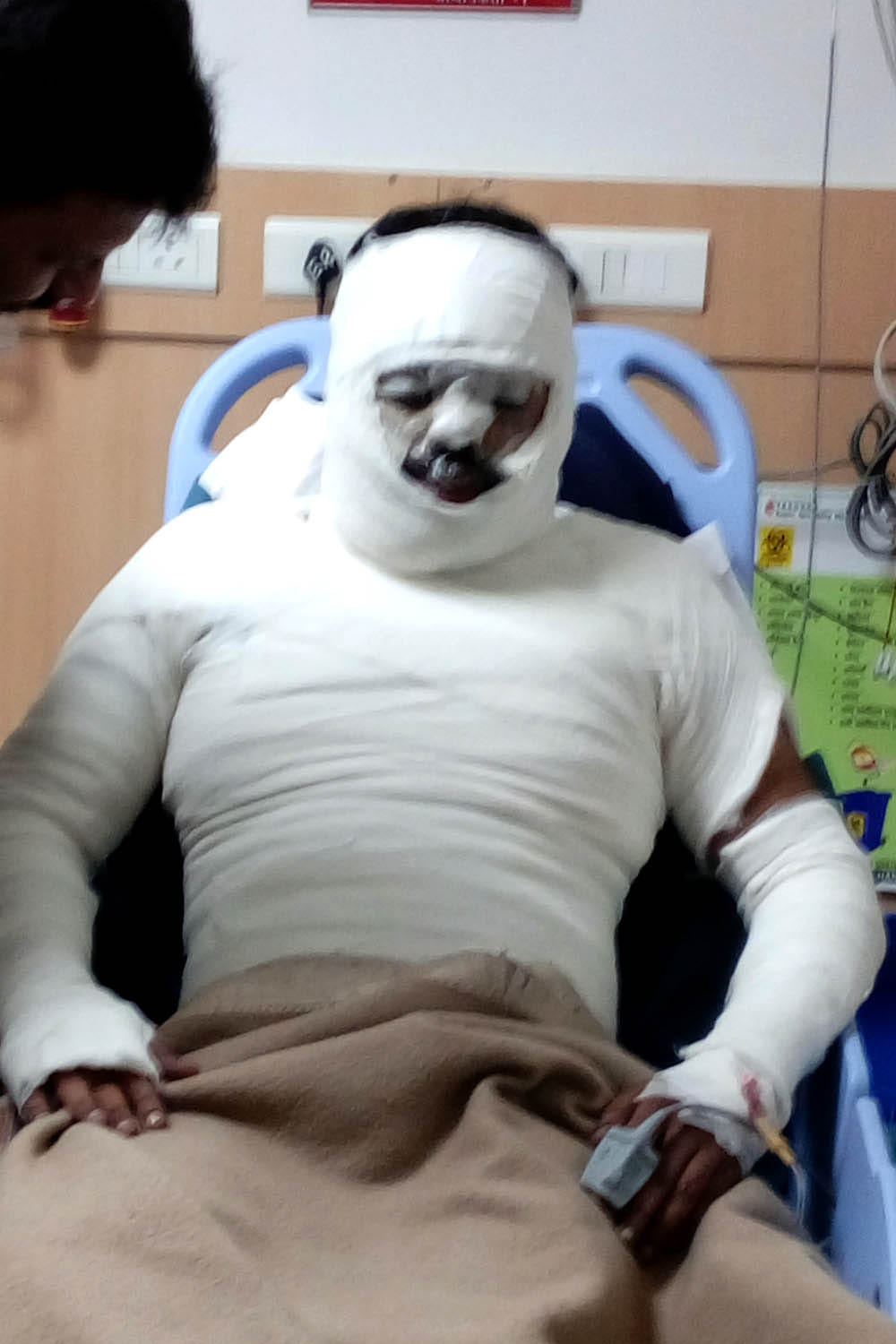 Tejab thrown at the clinic operator