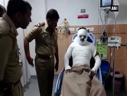 Jilted lover throws acid at VET doctor