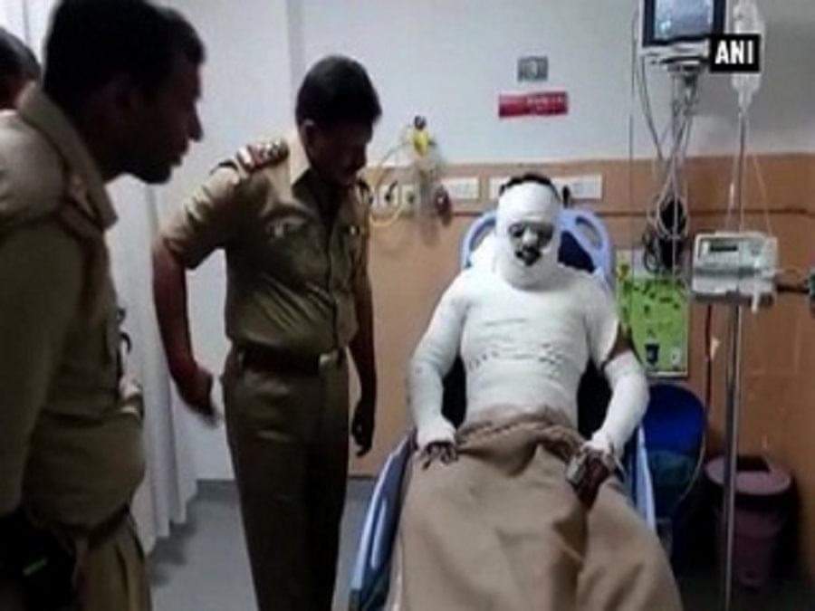 महिला ने फेंका तेजाब