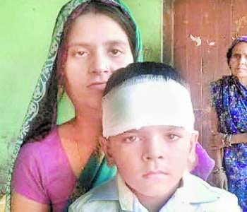 Principal and teacher beating student's head burst