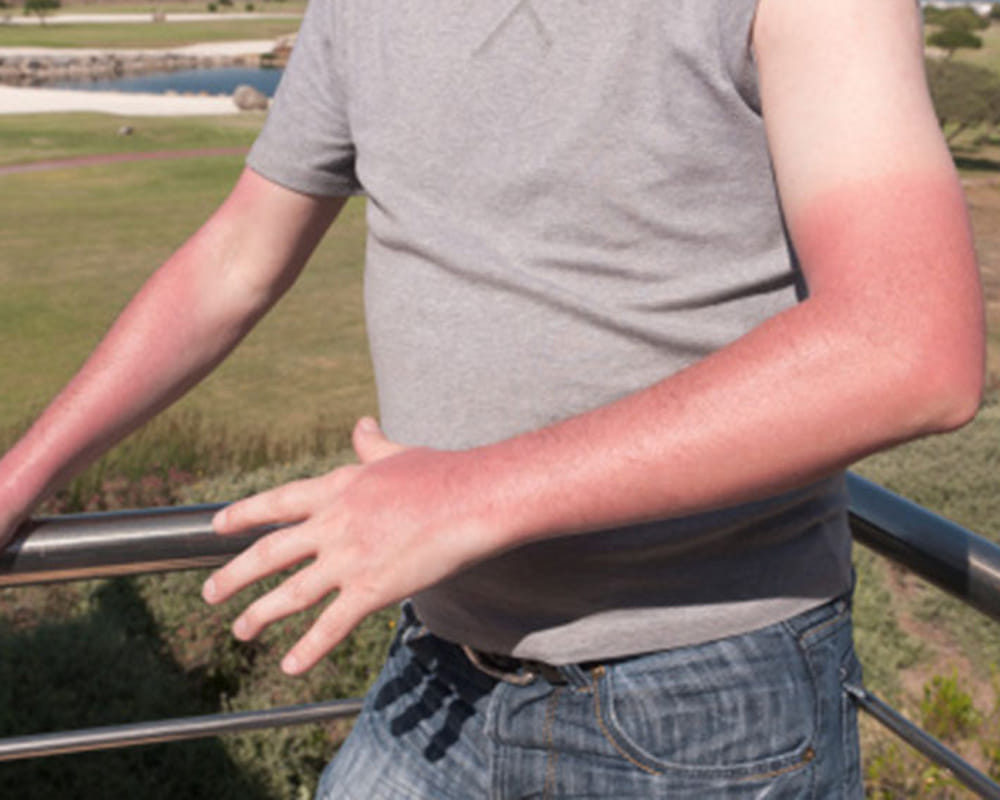 these bad habits harming your skin this summer
