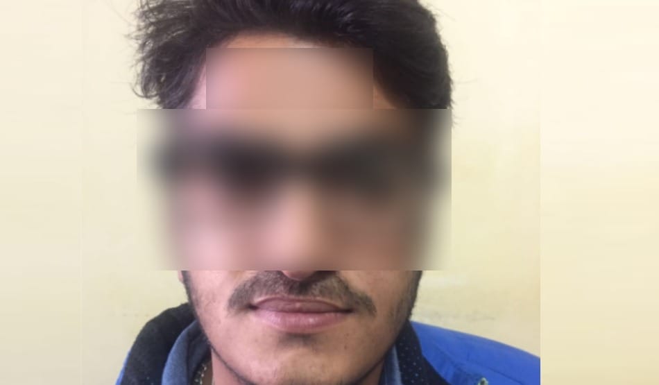Amazing PGI doctors, after surgery mustaches has grown 
