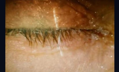 wife glues husband's eyes shut in rewa distt of mp