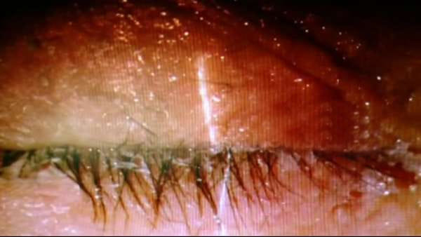 wife glues husband's eyes shut in rewa distt of mp