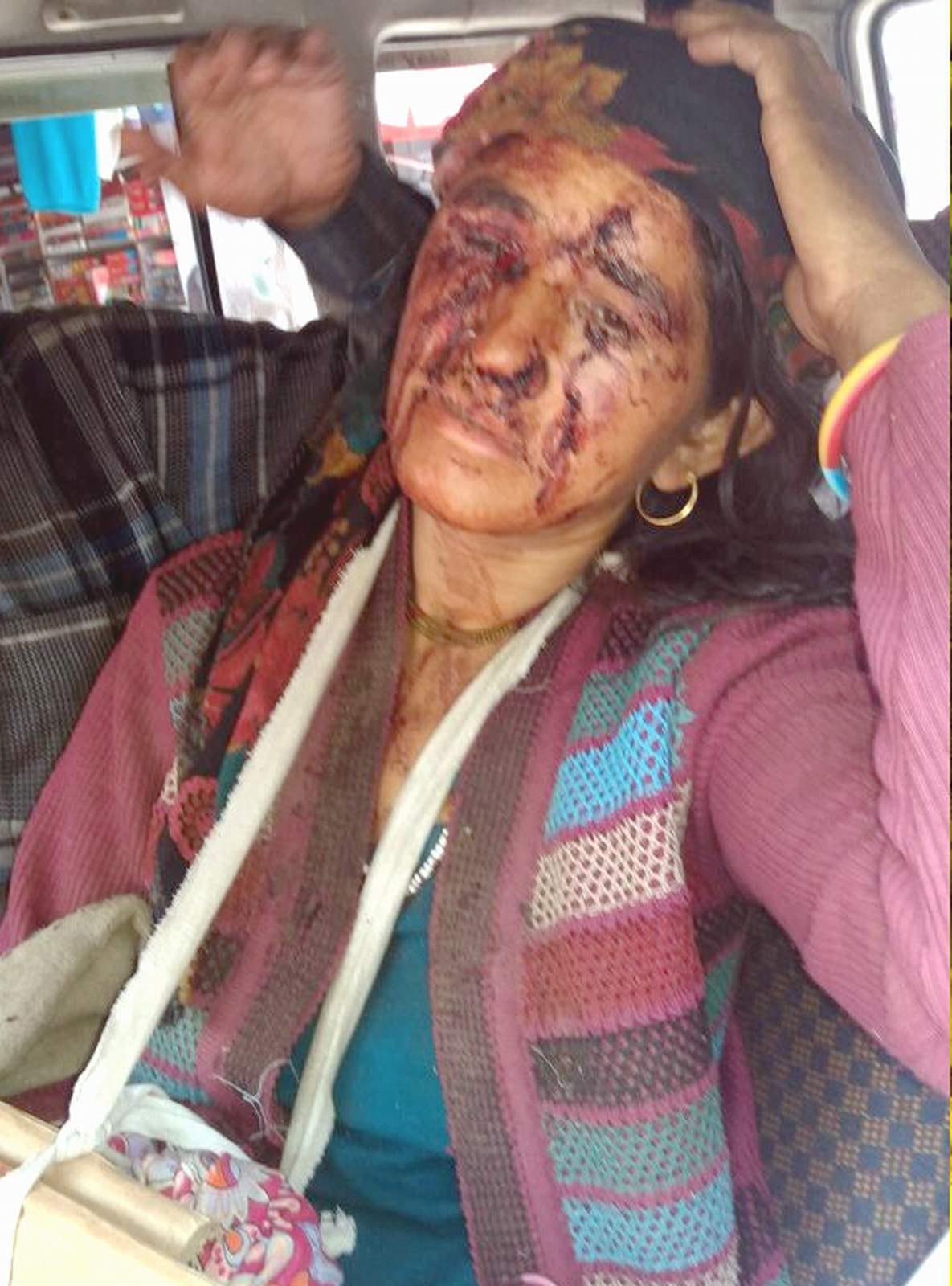 women injured to attack bear.