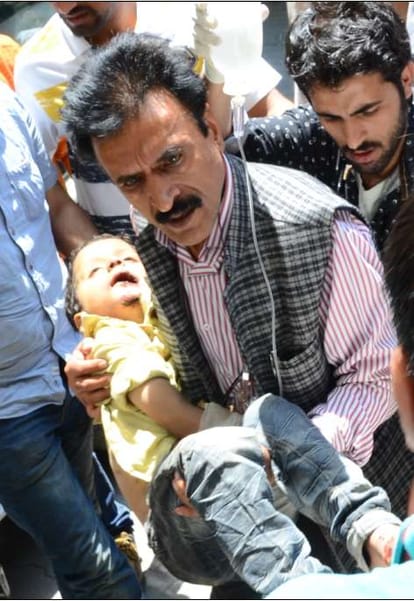 hrtc bus accident injured admitted in igmc hospital