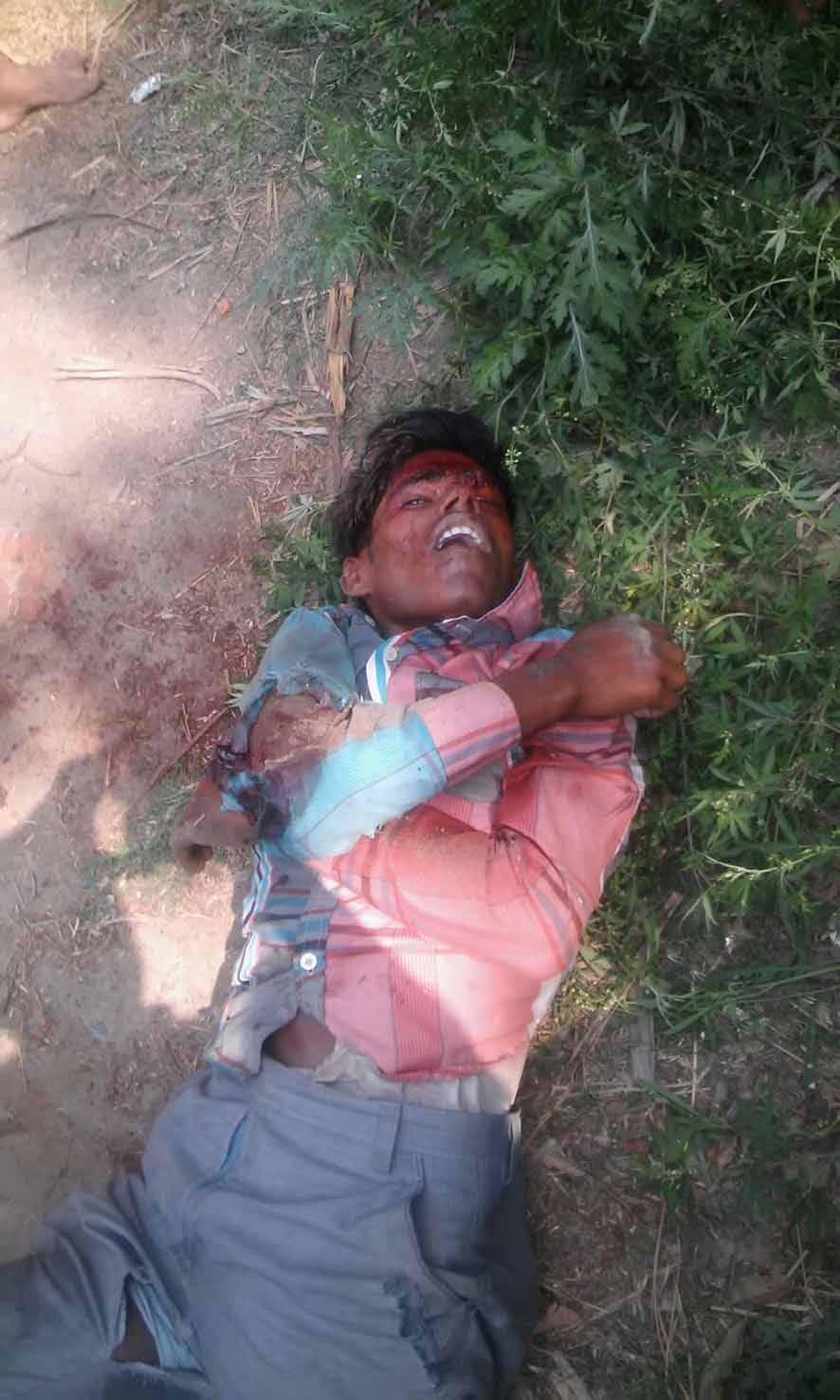  Two young serious bike riders in a road accident