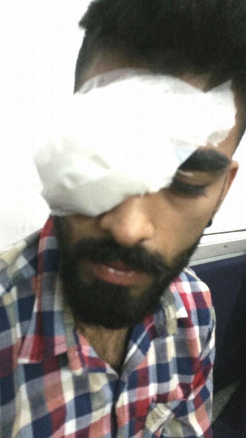 eyes of the young man watching a fight auto driver
