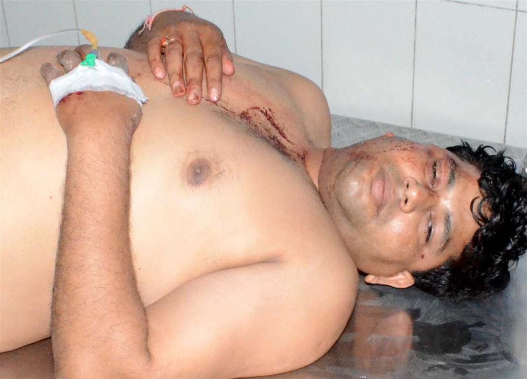 Teacher shot WagonR car robbed