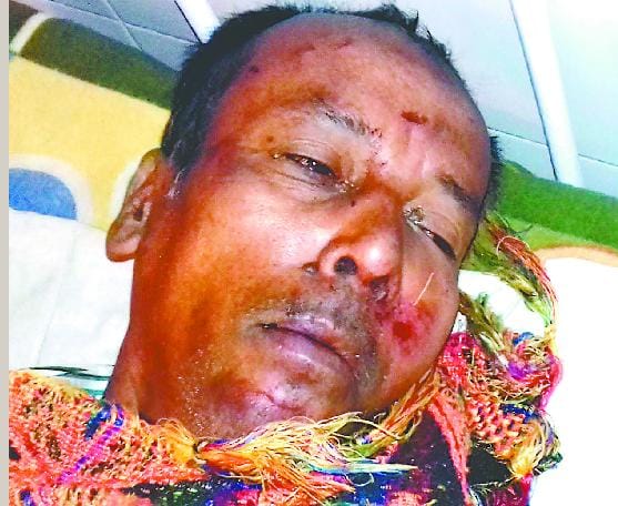 Mother, daughter seriously injured referred to Haldwani