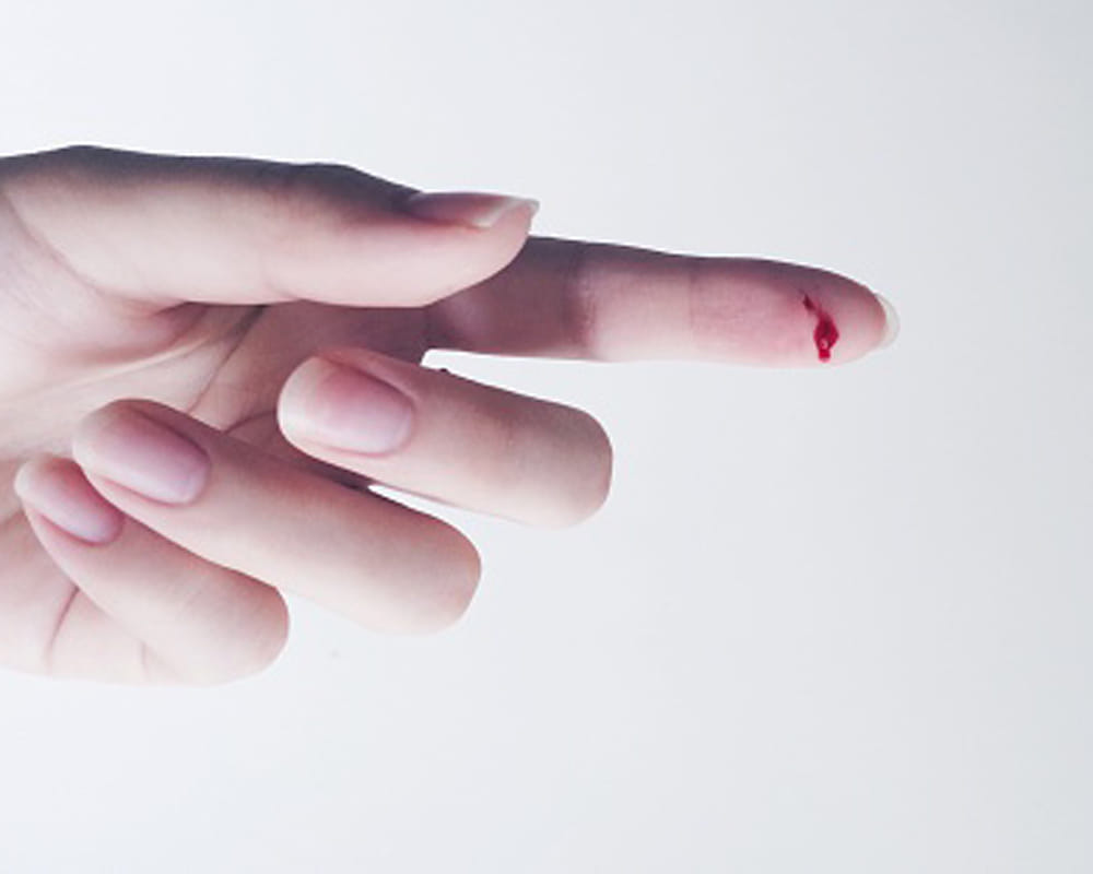 symptoms of deficiency of vitamin b 12
