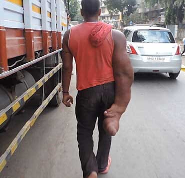 A man with huge 20kg arm 