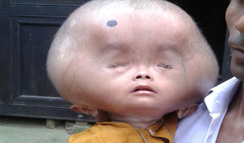 this boy's head is of 9 kg