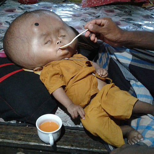 this boy's head is of 9 kg