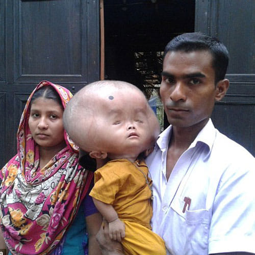 this boy's head is of 9 kg