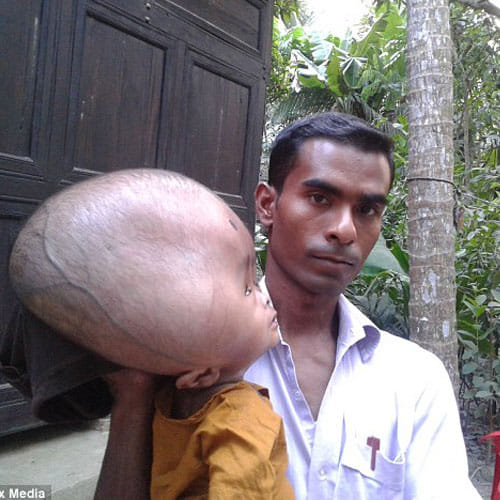 this boy's head is of 9 kg