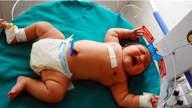 India's most overweight child