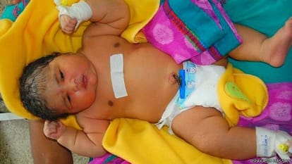 India's most overweight child