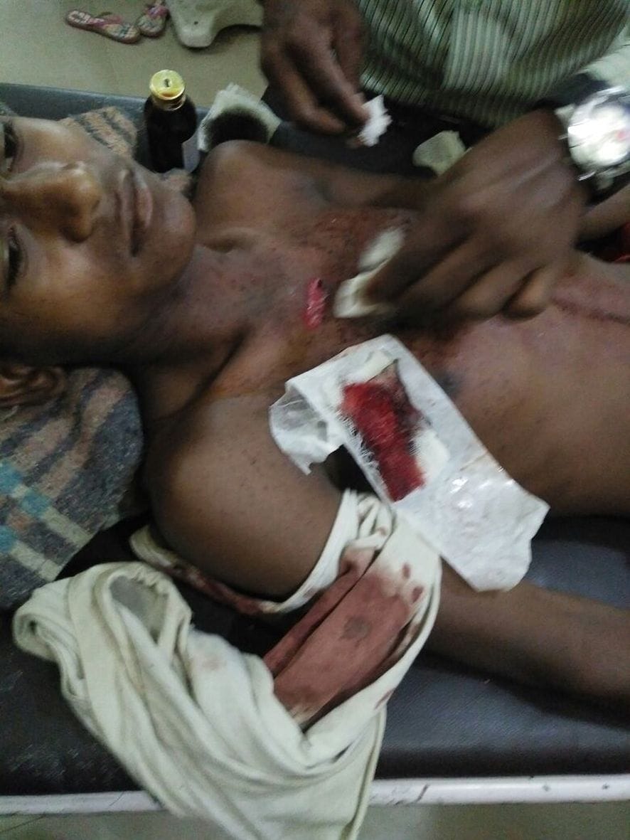Animal thieves shot the teenager, Serious