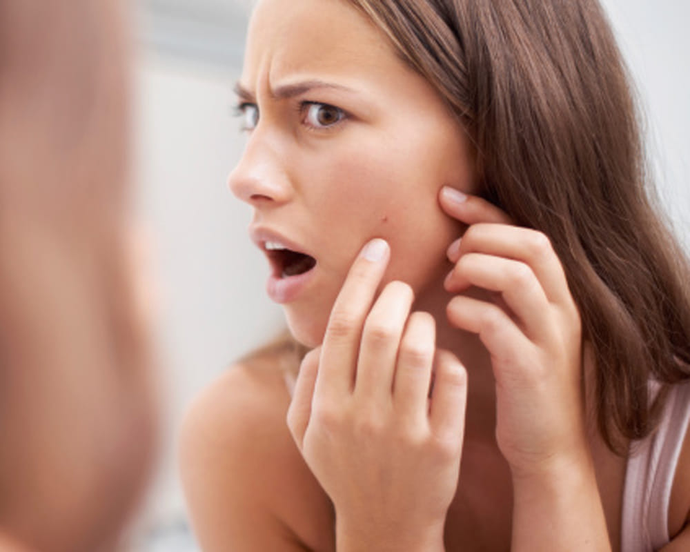 avoid these food for acne free skin